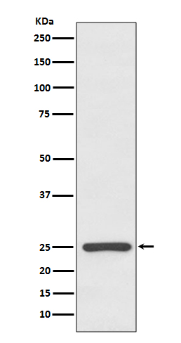 1 - Kappa light chain Antibody AP91181