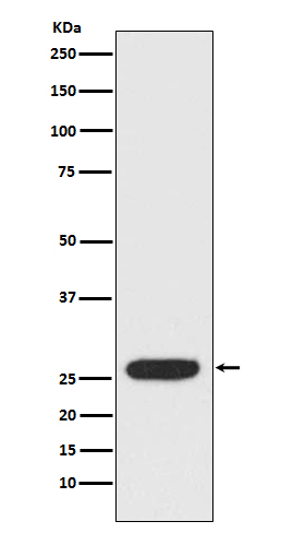 1 - StAR Antibody AP91511