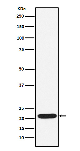 1 - SOCS2 Antibody AP91836