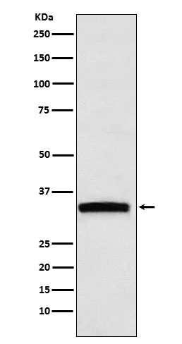 1 - GDF15 Antibody AP91965