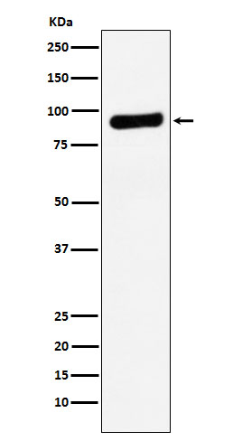 1 - RRM1 Antibody AP92011