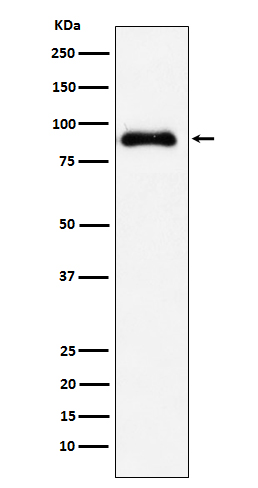 1 - SATB2 Antibody AP92062