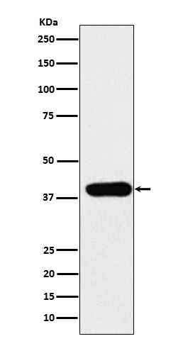 1 - ADA Antibody AP92392
