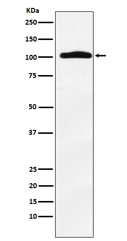 1 - Thyroid Peroxidase Antibody AP92409