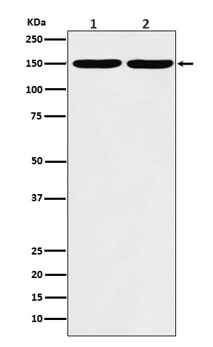 1 - Collagen III Antibody AP92678