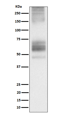 1 - Somatostatin Receptor 1 Antibody AP92790