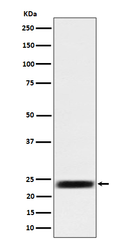 1 - ARFRP1 / ARP  Antibody AP92861