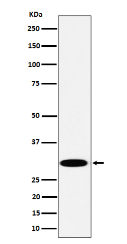 1 - TPMT Antibody AP92927