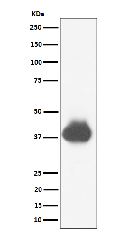1 - CD32A + CD32B + CD32C Antibody AP92935