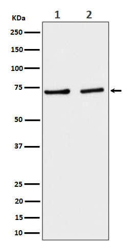 1 - SLC25A12 Antibody AP93071