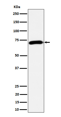 1 - Choline Acetyltransferase Antibody AP93179