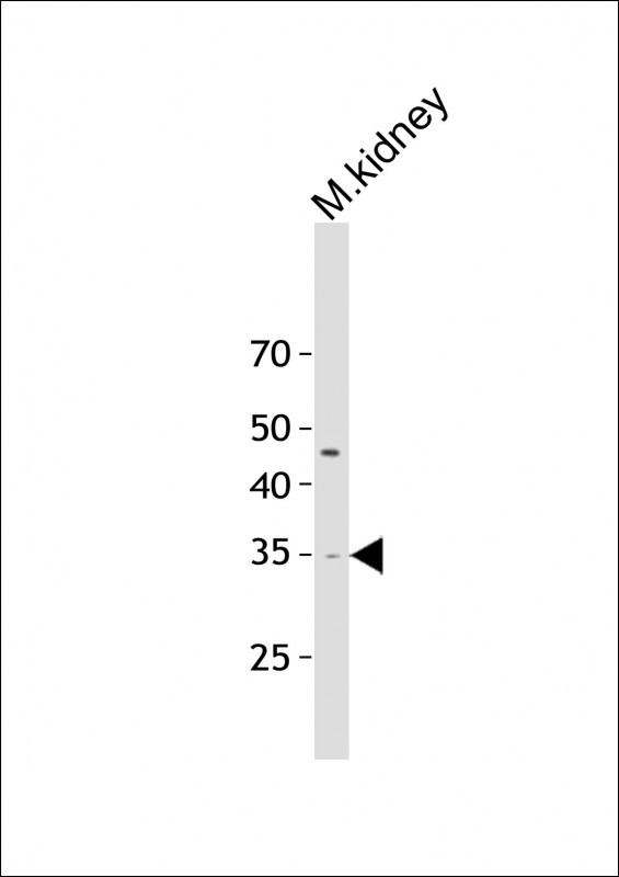 1 - MCAR1 Antibody  (N-term) AP10796a