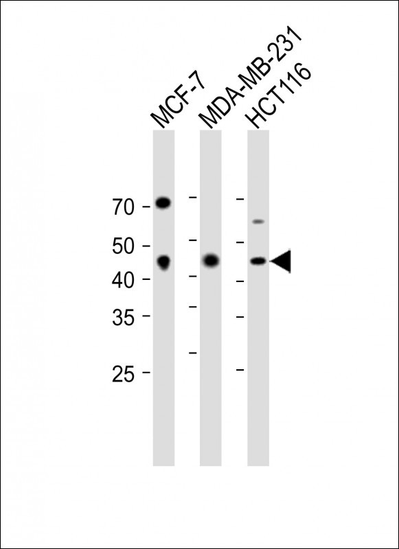 1 - GTF2H2C Antibody (C-term) AP11425b