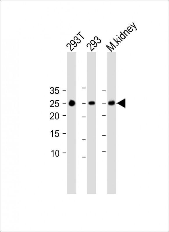 1 - RAB32 Antibody (N-term) AP17478a