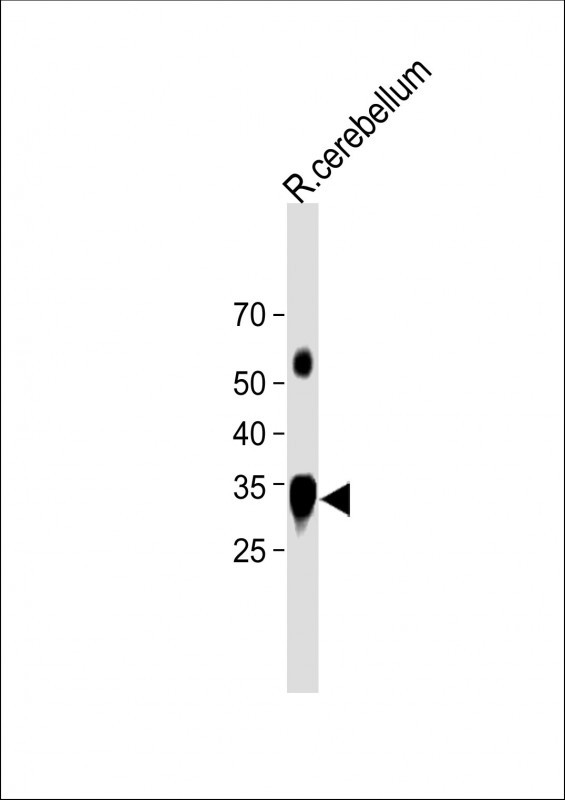 1 - STX1B Antibody (Center) AP21700c