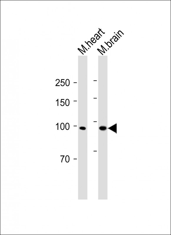 1 - LPR1(S4520) Antibody AP22410a
