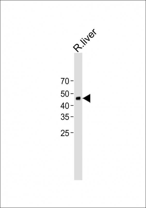 1 - FAH Antibody (N-term) AP11966a