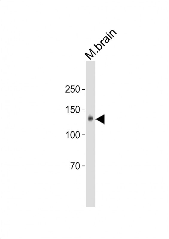 1 - PCDH1 Antibody (N-term) AP12019A
