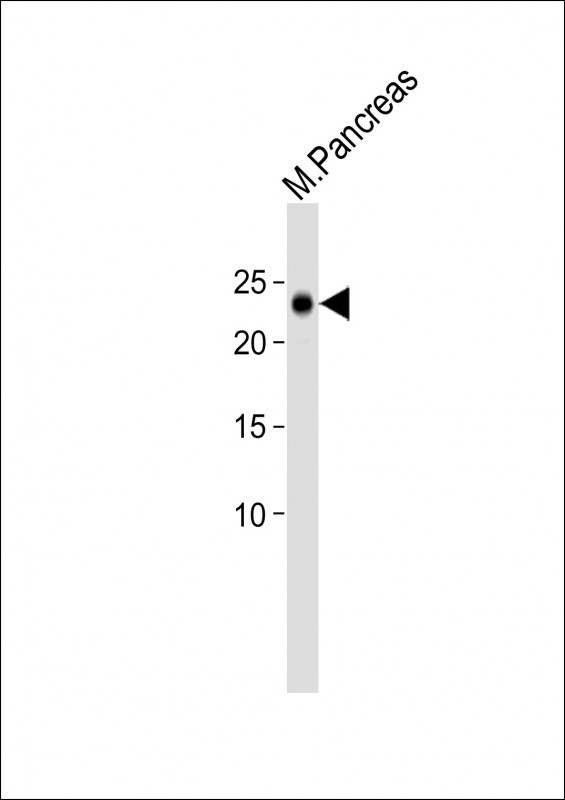 1 - SDF2L1 Antibody (C-term) AP13479B