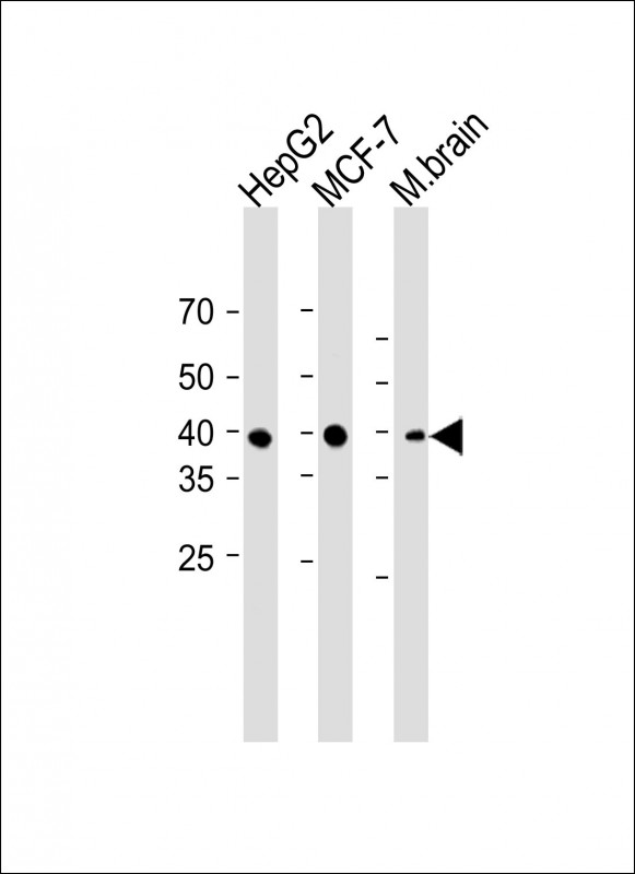 1 - FOLR1 antibody AP22431a