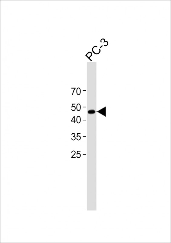 1 - TROP2 antibody AP22444a