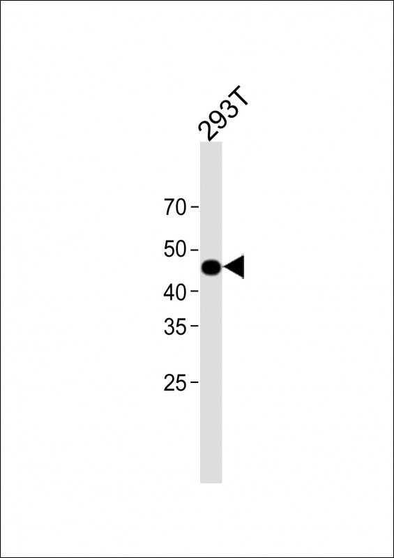 1 - RHD Antibody (Center) AP17214c