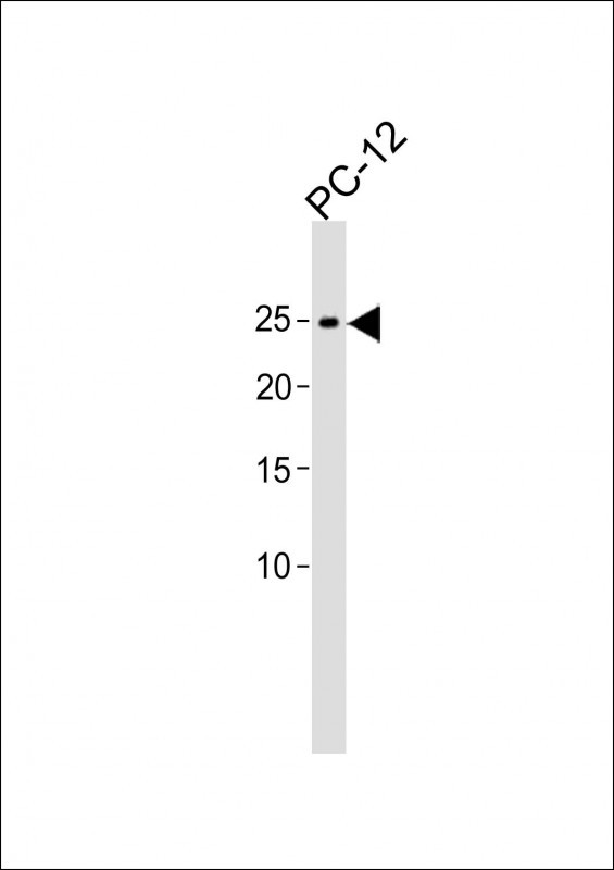 1 - EIF4E Antibody AP1954B