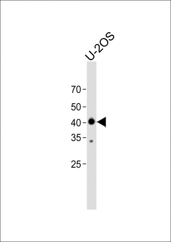 1 - M Abi3 Antibody (C-term) AP20504b
