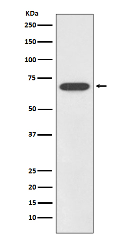 1 - SOX11 (12Z19) Rabbit Monoclonal Antibody AP93675
