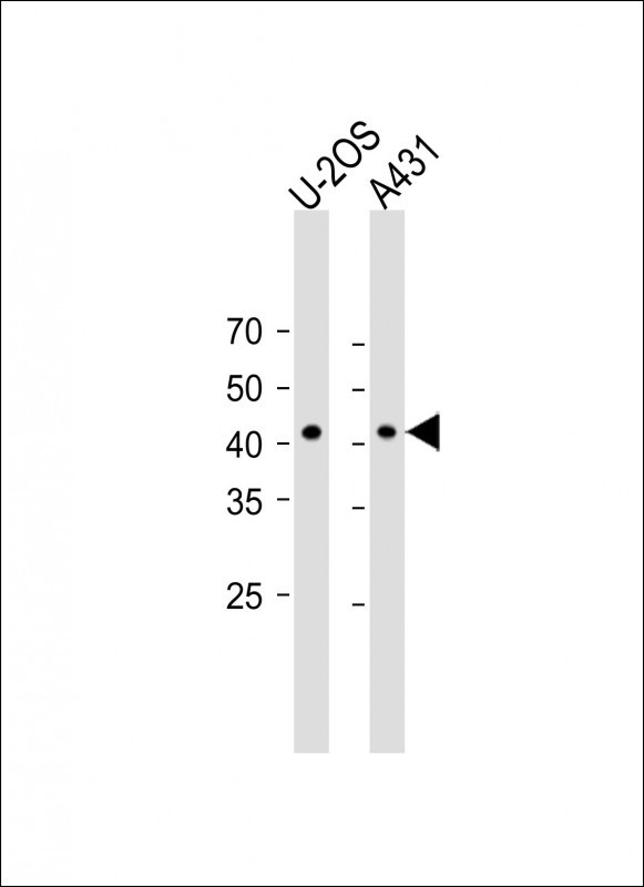 1 - NAT12 Antibody (C-term) AP11188b