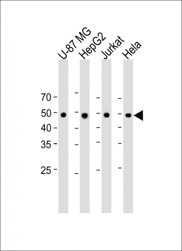 1 - Mouse Stk11 Antibody (C-term) AP17316b