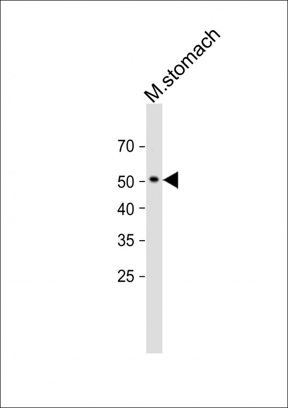 1 - SLC43A2 Antibody (Center) AP10062c