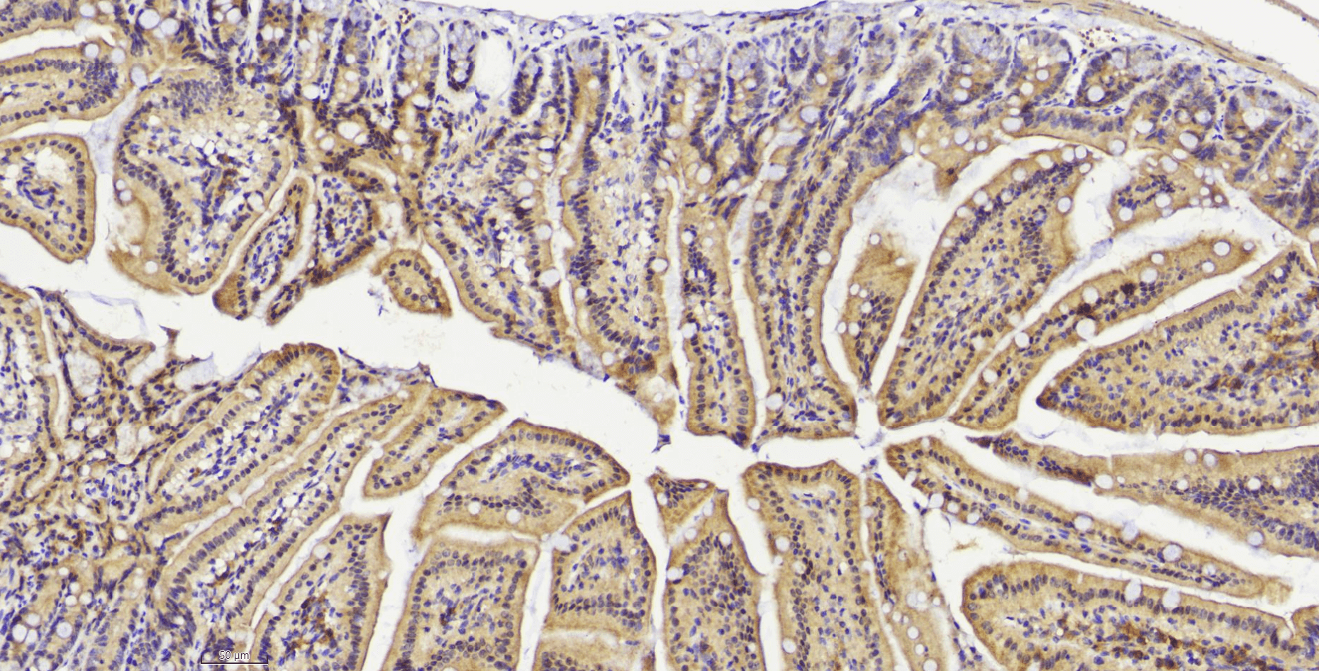 14 - PTEN antibody AP22433a