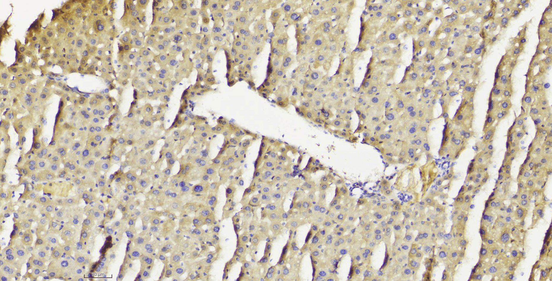 14 - PTEN antibody AP22433a