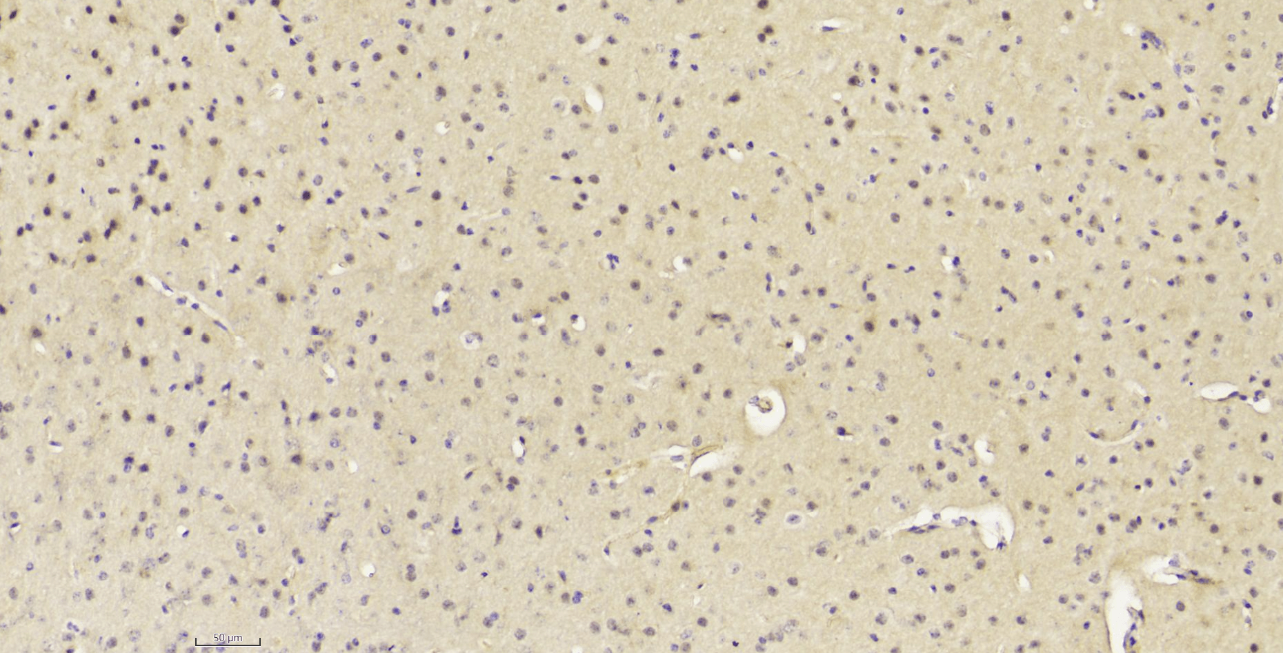 14 - PTEN antibody AP22433a