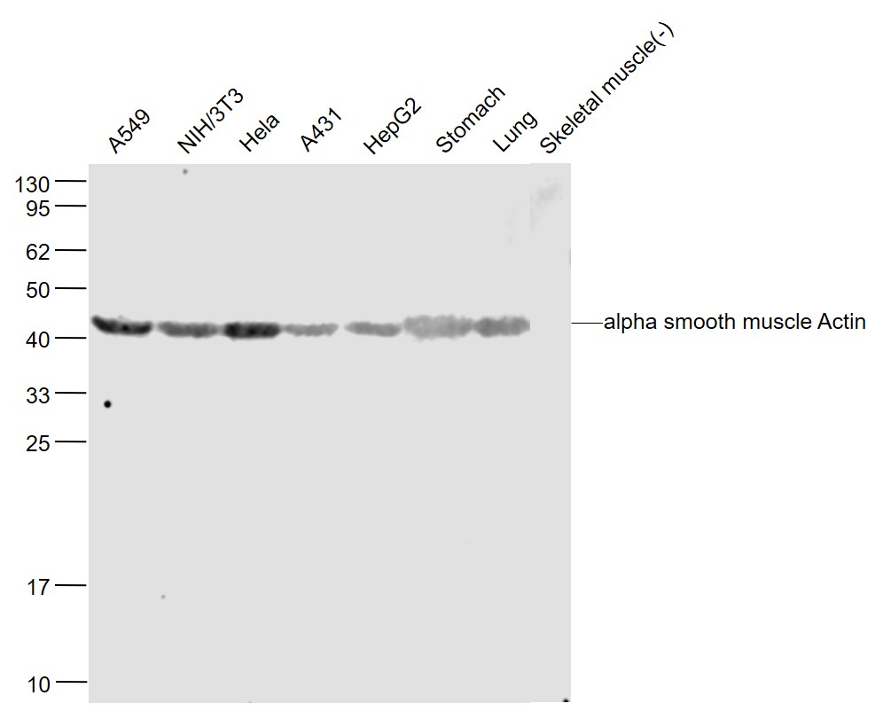 1 - alpha smooth muscle Actin Rabbit pAb AP50857
