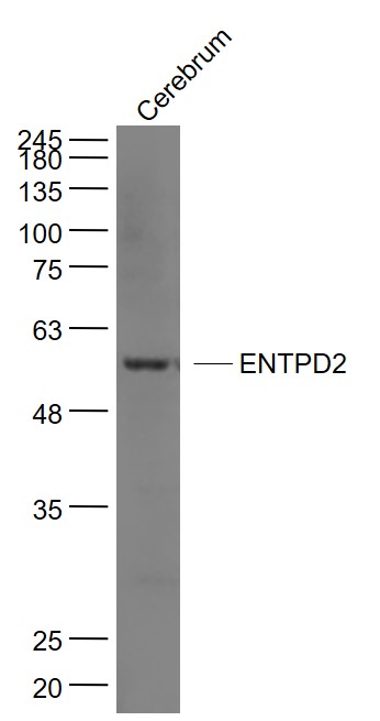 1 - ENTPD2 Rabbit pAb AP50877