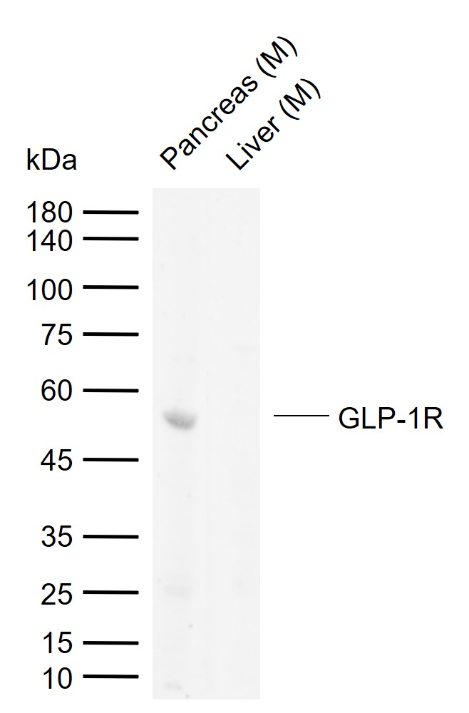 1 - GLP-1R Rabbit pAb AP52040