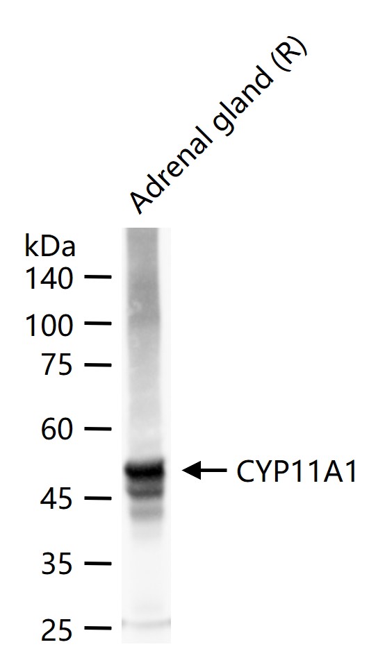 1 - CYP11A1 Rabbit pAb AP52081