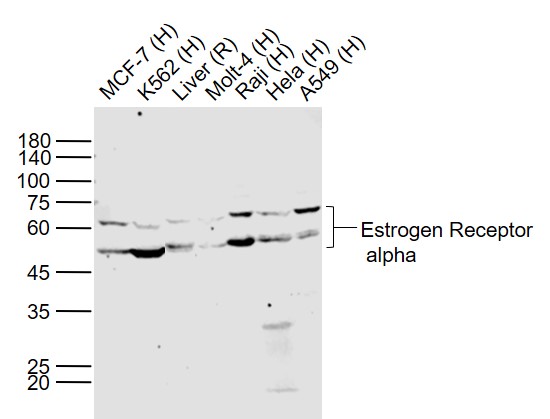 1 - Estrogen Receptor alpha Rabbit pAb AP52087