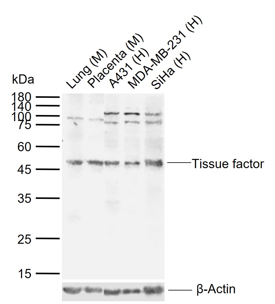 1 - Tissue factor Rabbit pAb AP52127