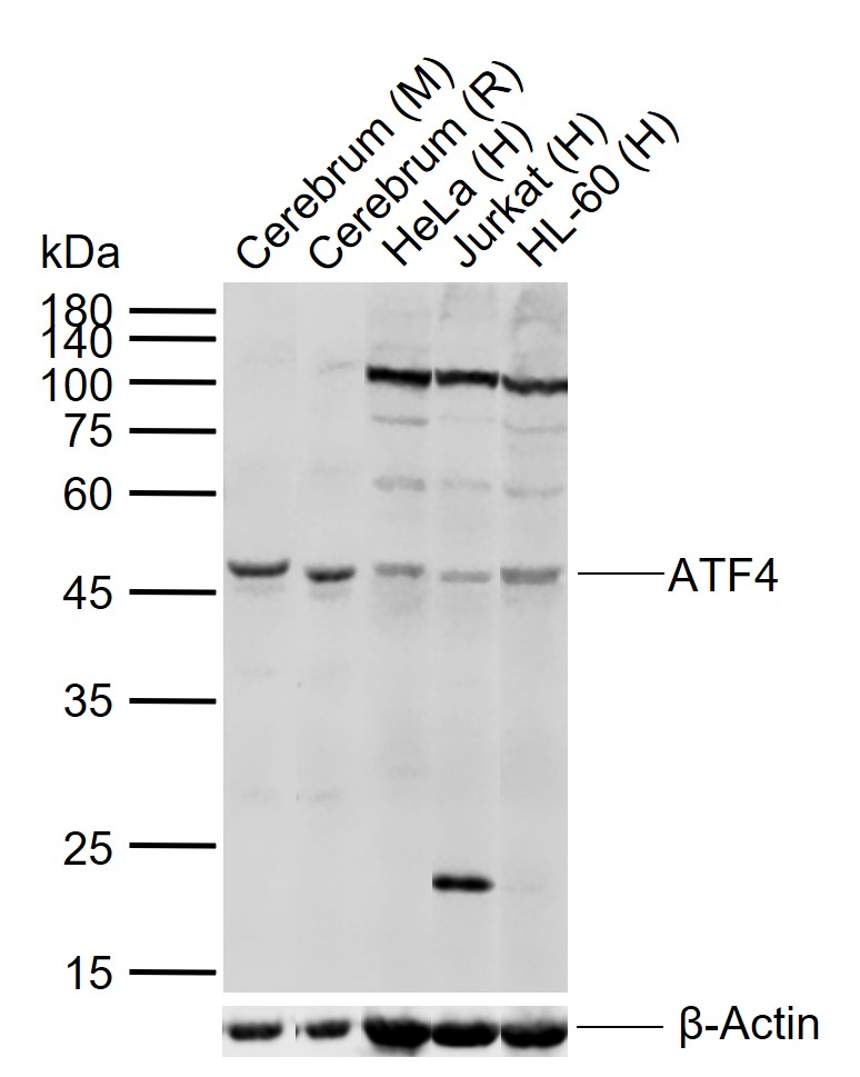 1 - ATF4 Rabbit pAb AP52146