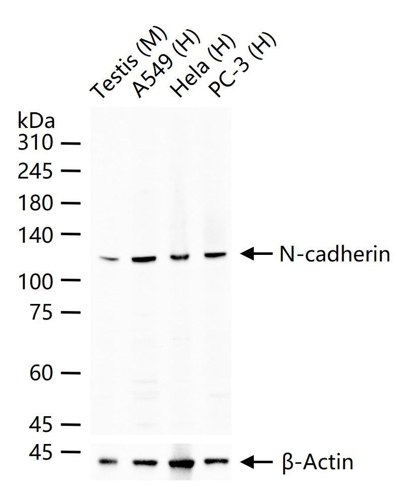 1 - N-cadherin Rabbit pAb AP52149