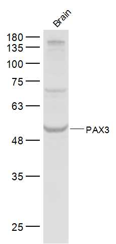 1 - PAX3 Rabbit pAb AP52171