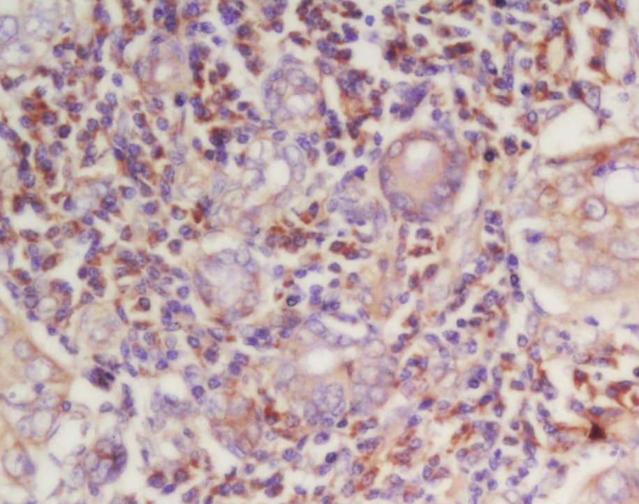 14 - Cyclin E1 Rabbit pAb AP52202