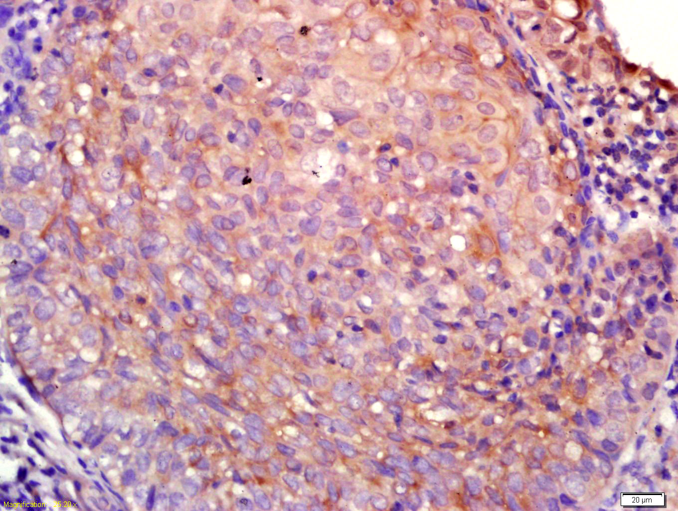 14 - Aquaporin 4 Rabbit pAb AP52226