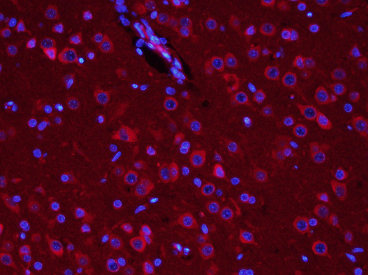 3 - TUBB3 (Neuronal Marker) Rabbit pAb AP52263