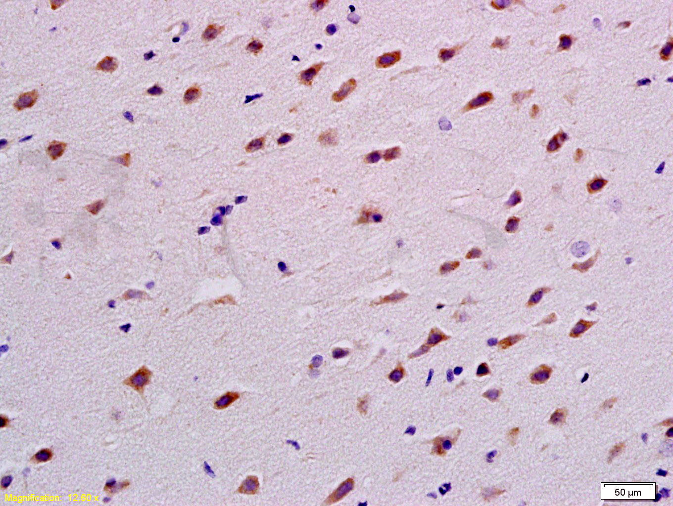 14 - TUBB3 (Neuronal Marker) Rabbit pAb AP52263