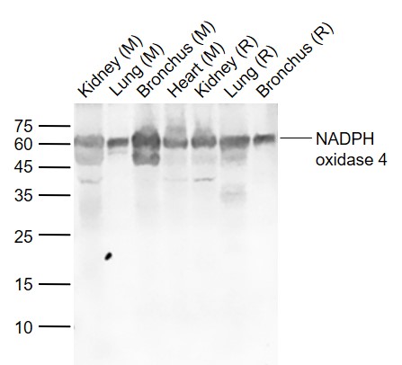 1 - NADPH oxidase 4 Rabbit pAb AP52323