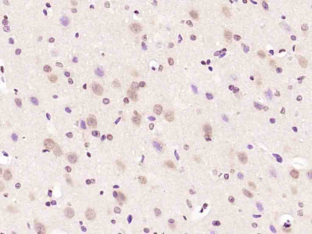 14 - FAR2 Rabbit pAb AP54241